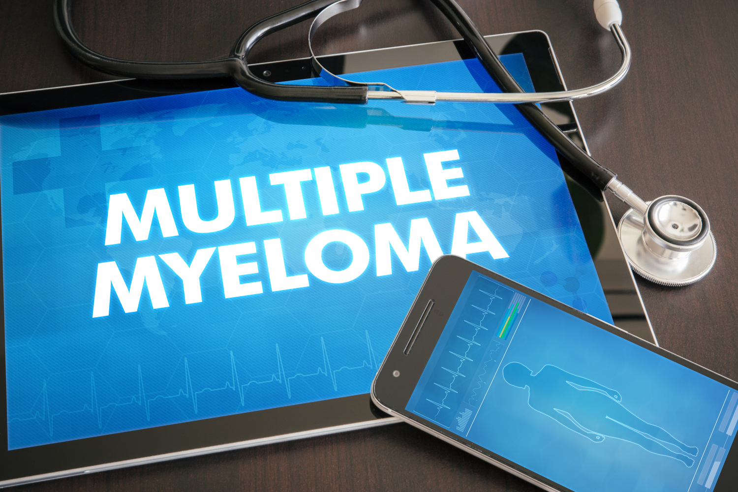 Stages of multiple myeloma: the Durie-Salmon system