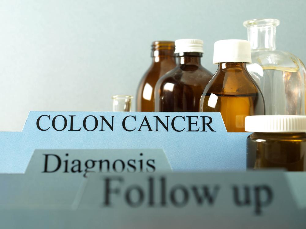 Colon cancer: Stages and treatments