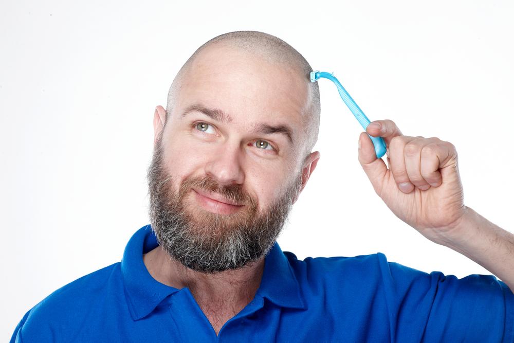 Symptoms and treatments for male pattern baldness