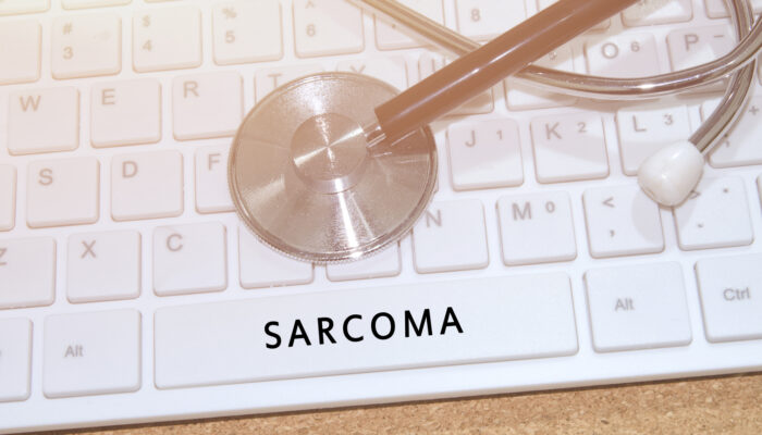 Common Symptoms of Sarcoma